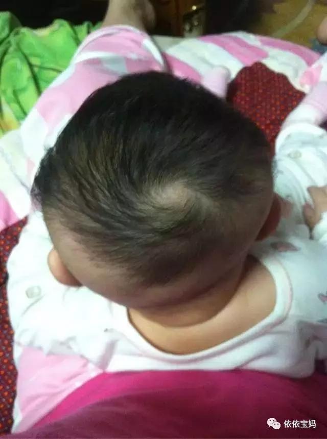 宝宝头型睡偏头了怎么调整过来,婴儿睡觉偏头怎么纠正图文