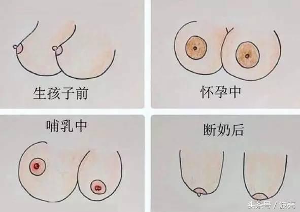 哺乳后的胸型变化,哺乳后的胸型变化对比