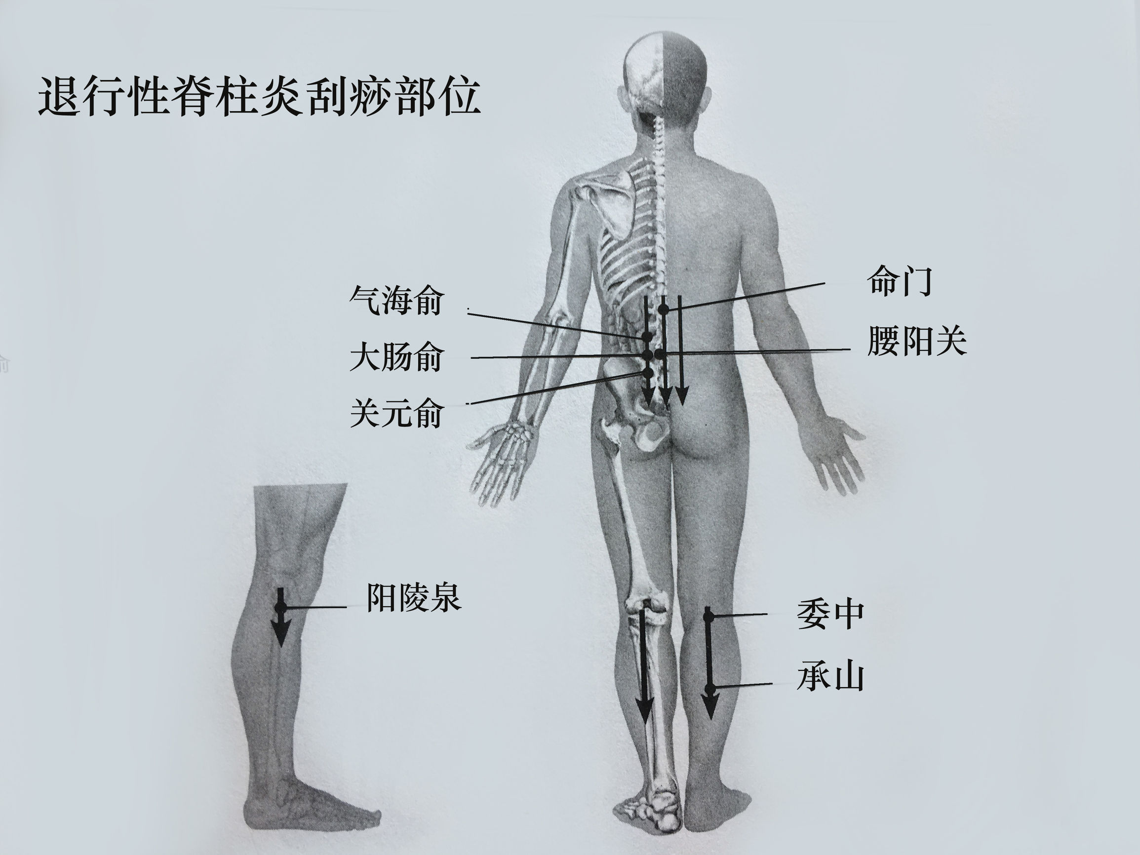梨状脊肌综合征怎么治了,退行性脊柱炎最佳治疗方案