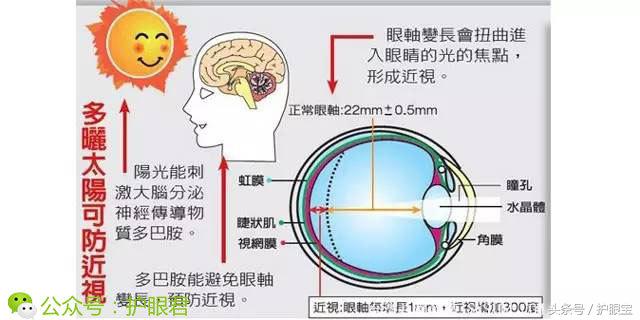 有没有成人矫正近视的办法,治近视是怎么做手术