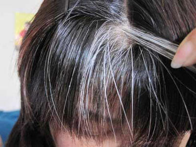 年纪轻轻就有白头发,简单4步可得到大大缓解