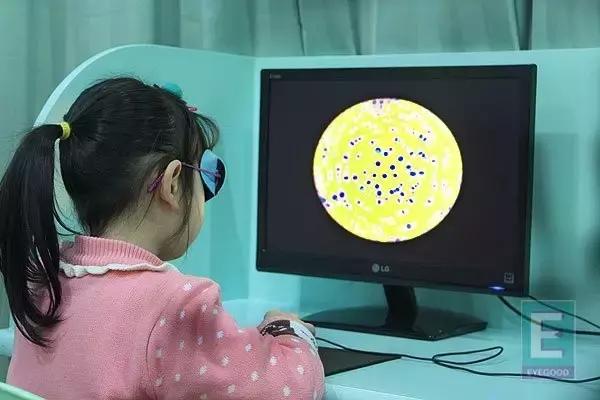 弱视这件鸟事，教你一眼识破（这是一篇眼科医生指导的文章）