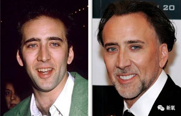 林允整牙却像整容?她是真的又整了啊!