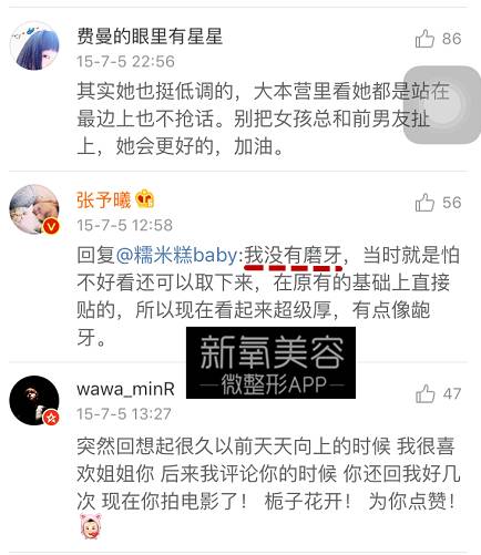 林允整牙却像整容?她是真的又整了啊!