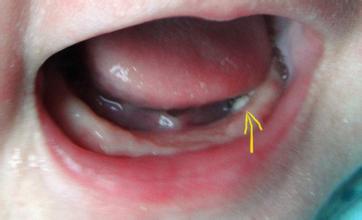 宝宝背后有什么秘密,宝宝身上藏的小秘密