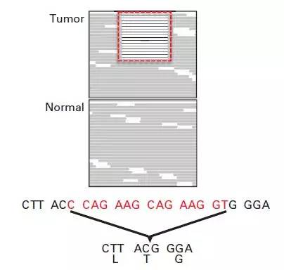 基因检测卵巢癌晚期有必要吗,基因检测卵巢癌风险高怎么办
