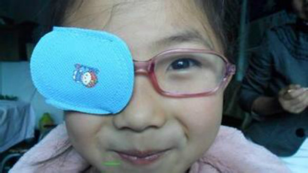 弱视这件鸟事，教你一眼识破（这是一篇眼科医生指导的文章）