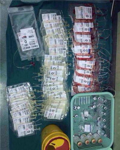 胎儿娩出后护士要做什么,胎儿娩出后2-3天产妇表现