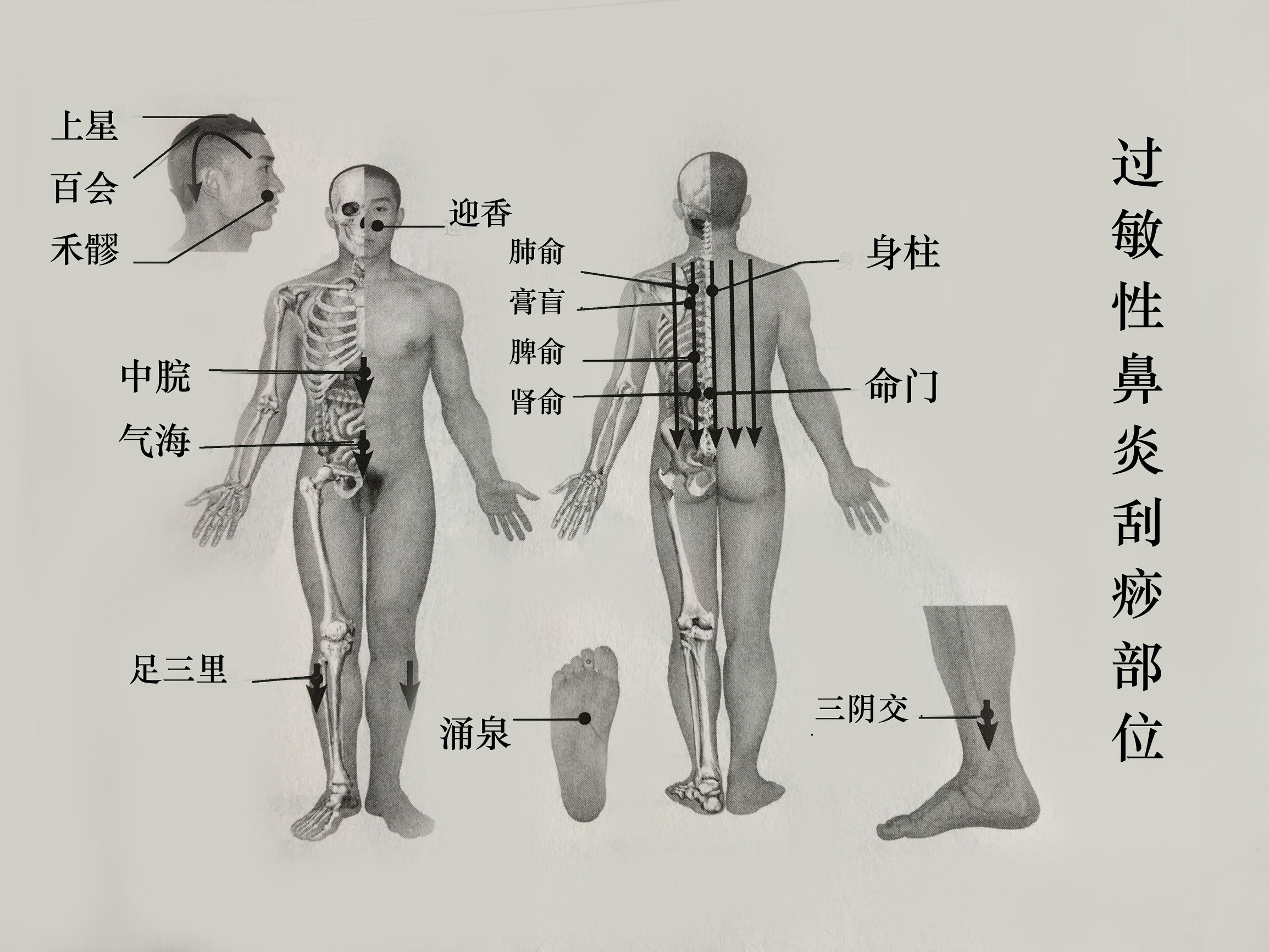 过敏性咽炎有哪些穴位,过敏性鼻炎和慢性咽炎刮痧方法