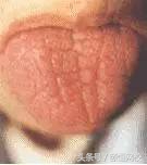 中医舌诊图谱100例,靠谱中医史上最全高清舌诊图谱