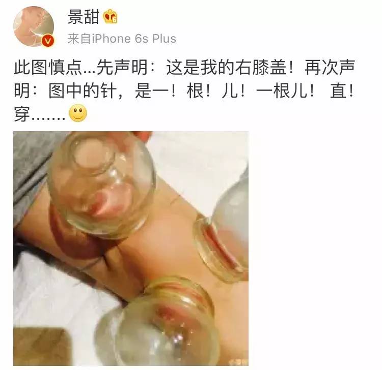 景甜素颜圈粉,景甜气场十足淡妆也很自信