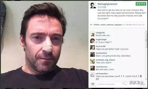 基底细胞癌切除干净还会复发吗,基底细胞癌最怕吃什么