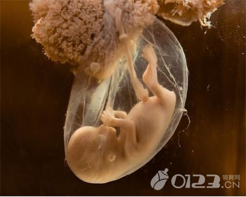 胎儿缺氧是羊水不足造成的吗,羊水不足对宝宝有什么影响