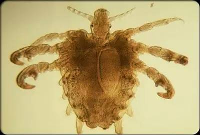 GET这14条，你就可以和疥疮拜拜了