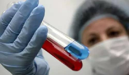 液体活检ctc报销不,肿瘤活检的标本在哪取