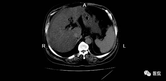 腹部疼痛病例报告,胸外科病例分析报告