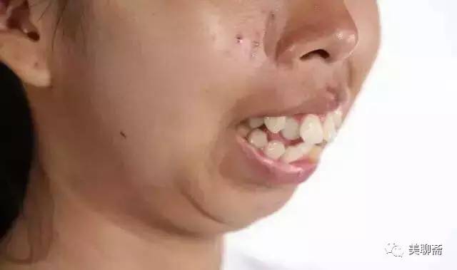 揭秘韩国整容术发达的原因,韩国整容业发达背后的原因