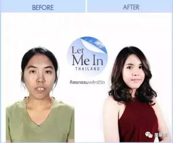 揭秘韩国整容术发达的原因,韩国整容业发达背后的原因