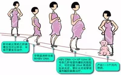母婴传播乙肝癌症几率,如何降低乙肝宫内感染