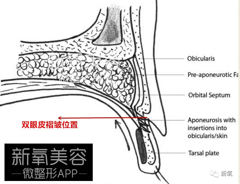 连范冰冰的脸都驾驭不了欧式平行大双，为什么？
