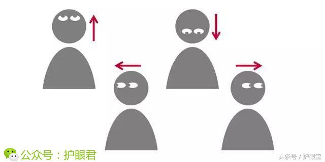 有没有成人矫正近视的办法,治近视是怎么做手术