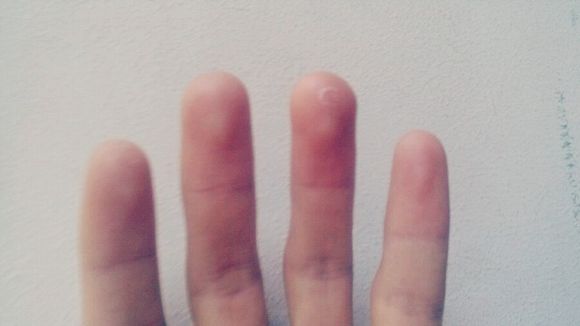 看看你到底有什么病,看看你有没有这些症状