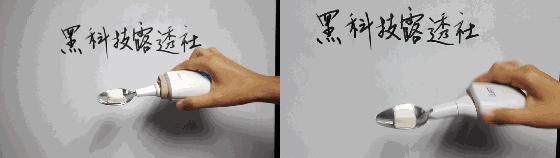 帕金森的几个误区你中招了吗,治帕金森黑科技