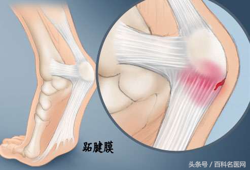 脚后跟疼不走路也疼怎么回事,小孩脚后跟疼不红不肿是什么原因