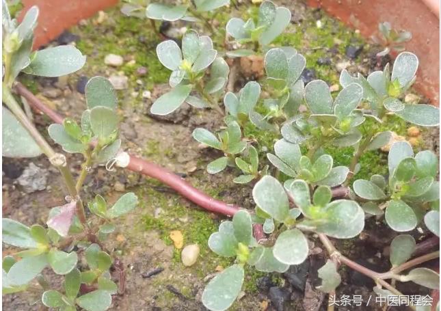 马齿苋可外敷治牙痛吗,马齿苋怎么治牙痛