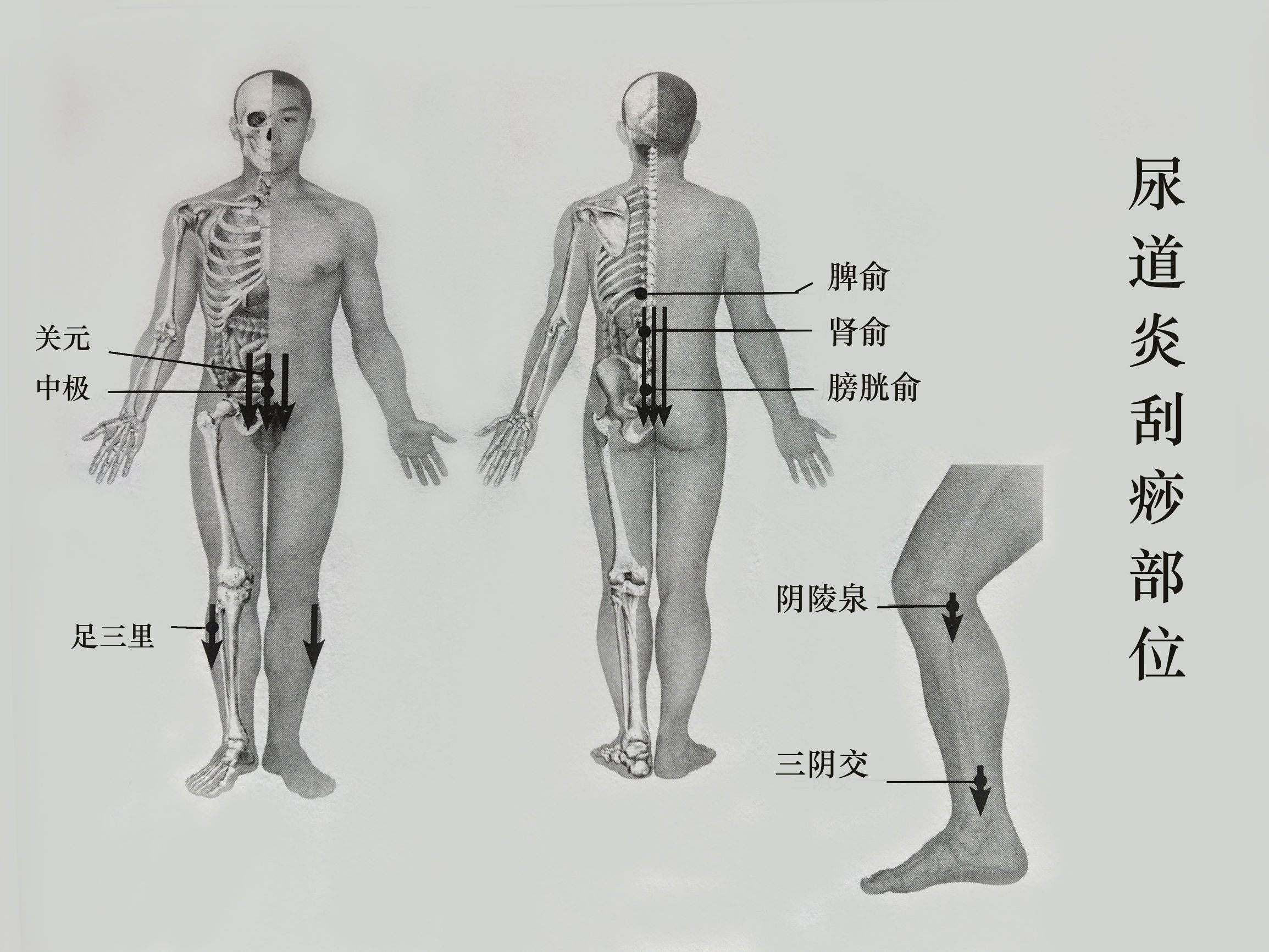 尿道炎的艾灸治疗,尿道炎刮痧