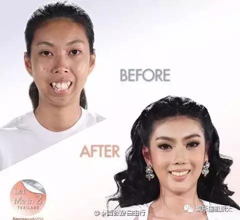 泰国专门的整容节目,泰国的整容节目有哪些