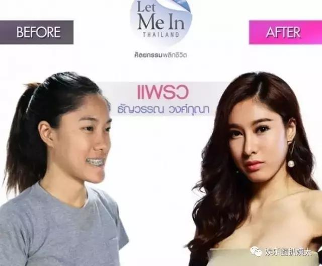 泰国专门的整容节目,泰国的整容节目有哪些