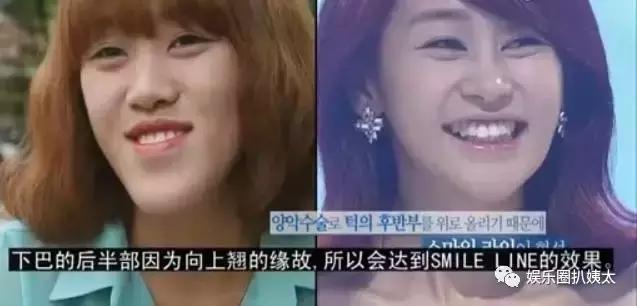 泰国专门的整容节目,泰国的整容节目有哪些