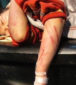 男孩疯狂自虐，浑身伤痕累累，一切都是为了妈妈