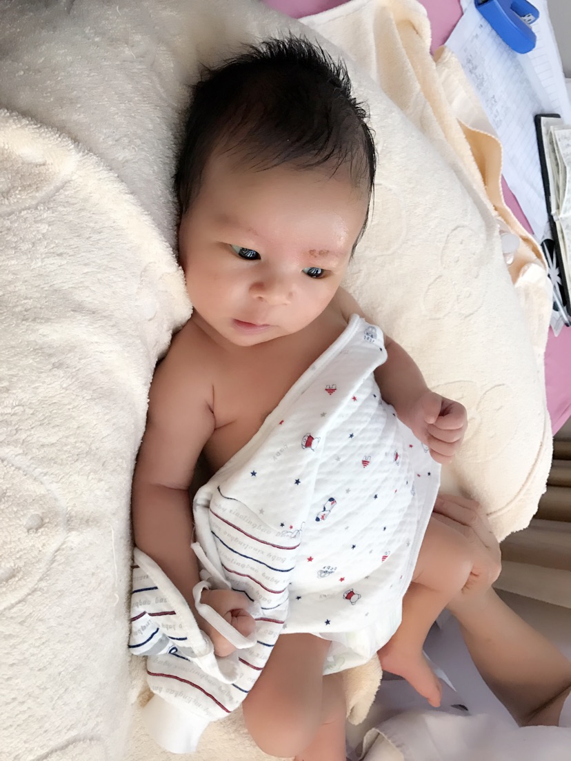 黄疸光晒能解决问题吗,与黄疸作斗争