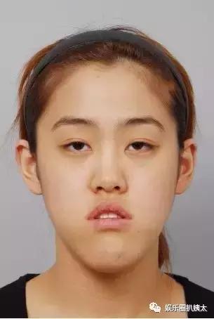 泰国专门的整容节目,泰国的整容节目有哪些