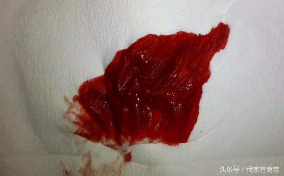 临近预产期哪些症状说明宝宝出生,宝宝会在预产期前后多久出来