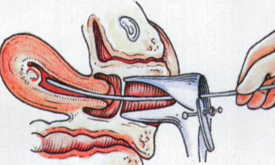 不育不孕都是它惹的祸,不孕不育的五大元凶