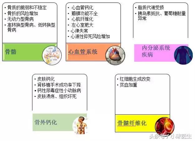 继发性甲状旁腺功能亢进是什么病,继发性甲状旁腺功能亢进怎么治