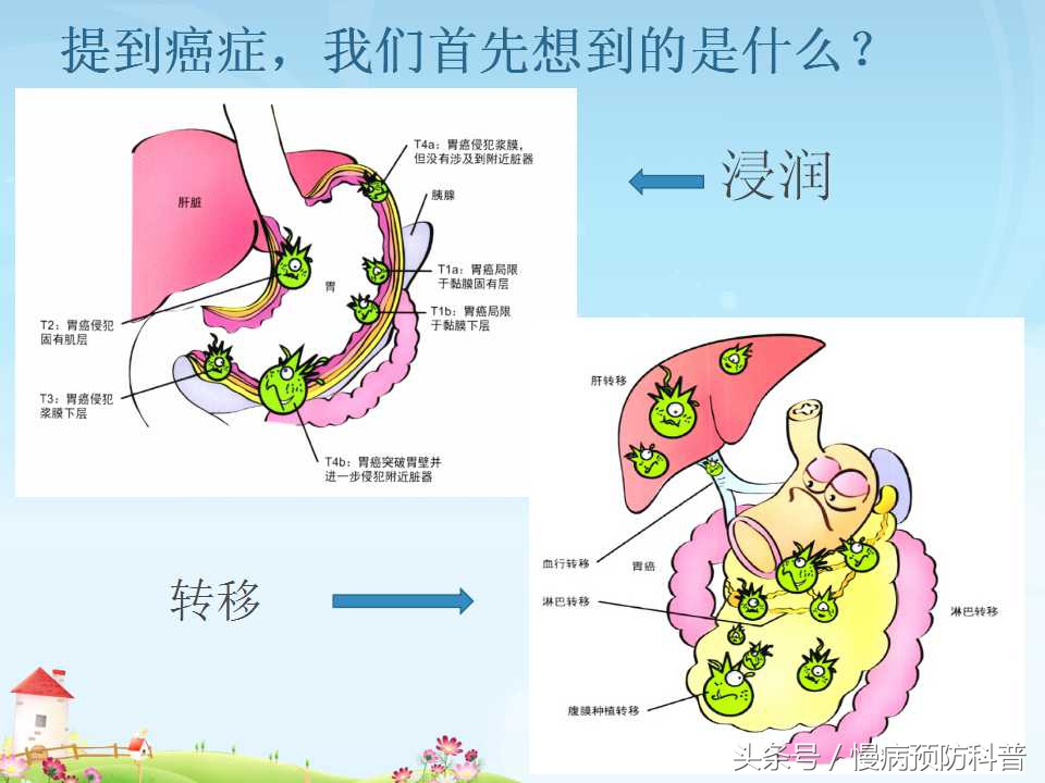 幽门螺旋杆菌吃什么药立竿见影,幽门螺旋杆菌赶尽杀绝