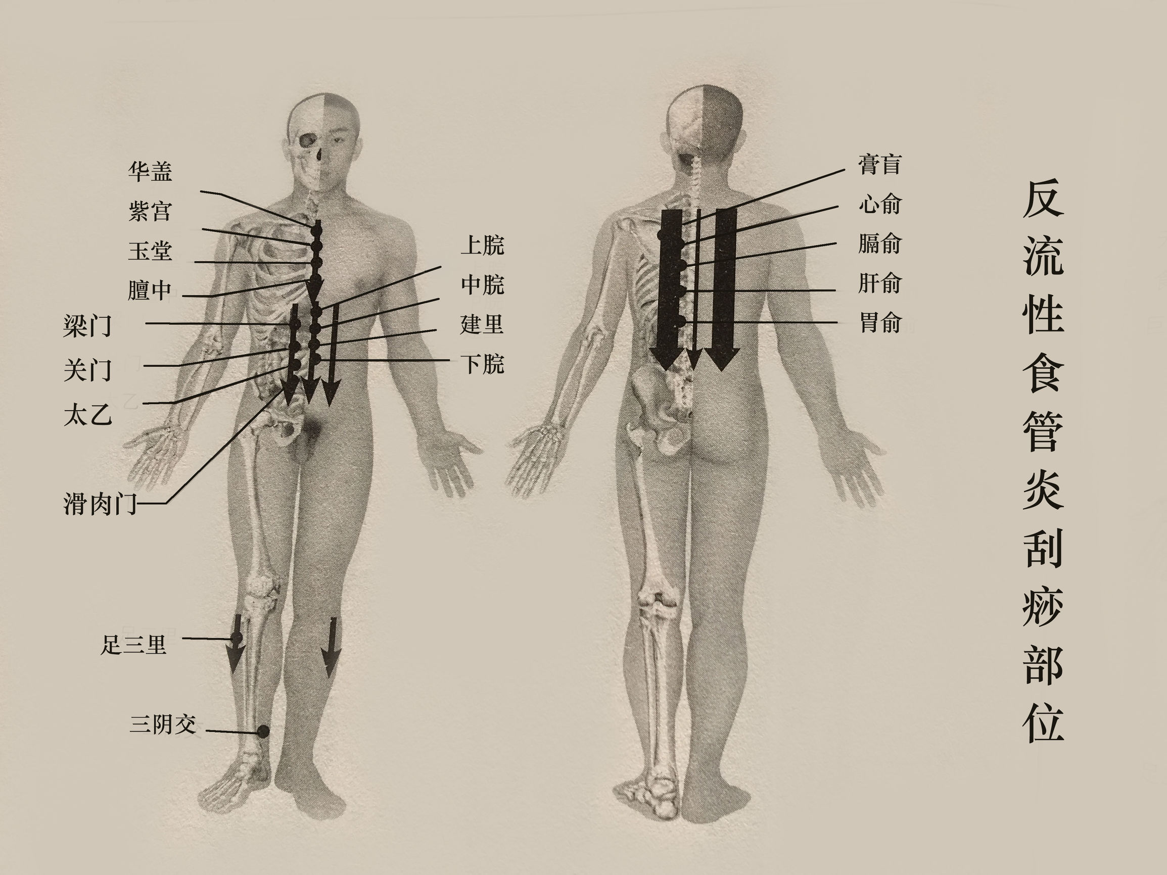 胃反流性食管炎挂什么科,胃肠炎反流性食管炎用什么药