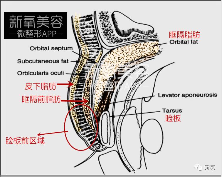 连范冰冰的脸都驾驭不了欧式平行大双，为什么？
