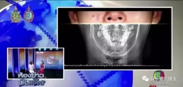 泰国专门的整容节目,泰国的整容节目有哪些