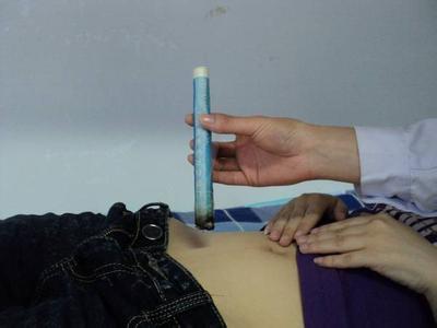 经期之痛，怎么解决痛苦，或许只有针灸才能一劳永逸！