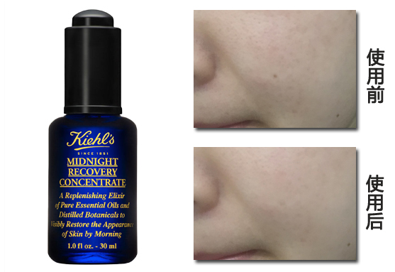 科颜氏夜间修护精华液可以白天用吗,科颜氏夜间修护精华液适合年龄