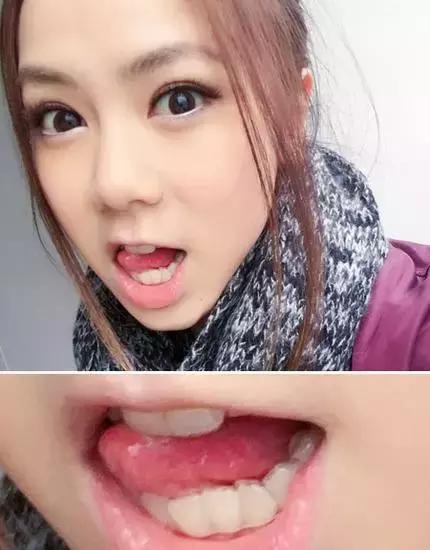 整牙=整容？看杨幂、刘涛、高圆圆为你亲身示范！