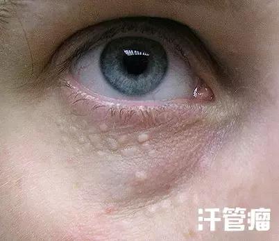 眼周有细纹用什么眼霜好用,护理眼周先用眼精华还是先用眼霜