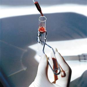 服用盐酸厄洛替尼片饮食禁忌 (吃厄洛替尼片有什么副作用)