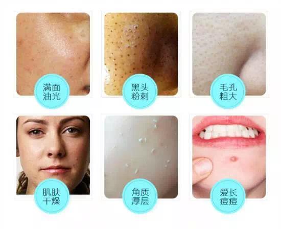 雾霾会伤肺吗 (雾霾洗肺)