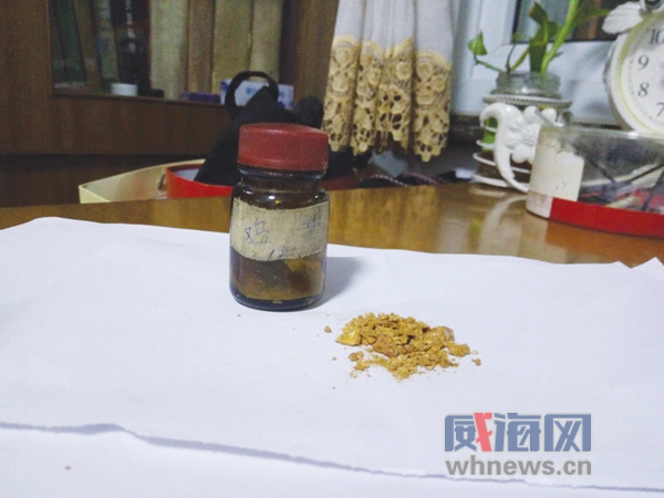 又现“鸡宝”！7旬老人“宝贝”珍藏40多年